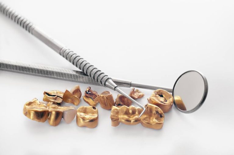 Finding the Best Place to Sell Dental Gold